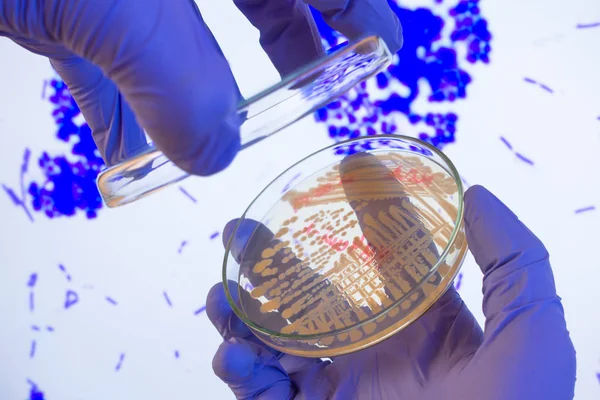 Opening a Petri dish against a background of a photograph of bacteria. Petri dish with bacteria on the background of photography with a microscope.