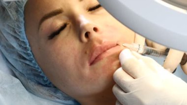 Dudak geliştirme yordamı. Tıbbi şapkalı kadın Dudak enjeksiyon alır. Eldiven profesyonel güzellik uzmanı güzellik enjeksiyonları yapar. Yüz kaldırma kavramı. 4k