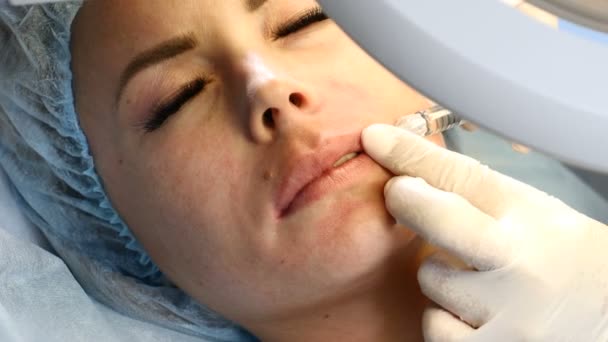 Mujer de mediana edad en una clínica de belleza que recibe inyecciones de toxina botulínica. Primer plano de las manos esteticistas con aguja de cánula. 4k — Vídeos de Stock