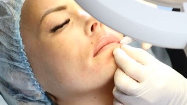 Doktor ya da güzellik uzmanı, kaldırma için kanül iğne kullanarak orta yaşlı bir kadın için dikmek ürpertiyor. Biorevitalization ve Mezoterapi. 4k