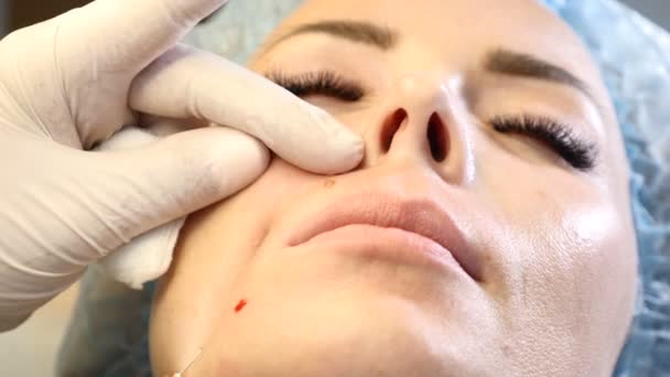 Primer plano de la mujer en el centro de belleza y cosmetólogo con jeringa en las manos. Doctor haciendo inyecciones antiarrugas. 4k — Vídeos de Stock