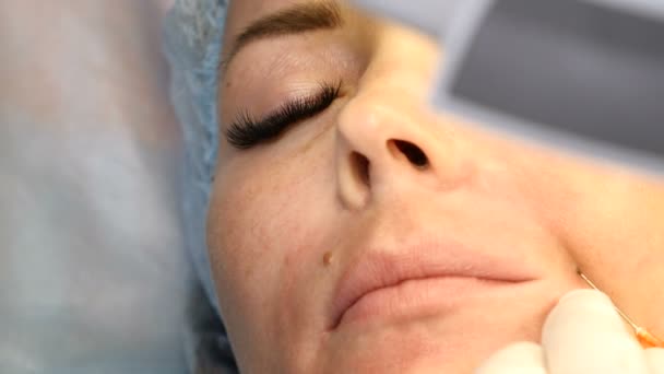 Cosmetologist makes a skin beuaty prick for a middle-aged woman with cannula needle. Face lifting procedure. Biorevitalization and mesotherapy. — Stock Video