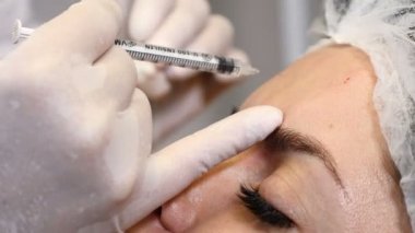 Kadın yüz germe. Şevval özçelik güzellik eldiven bir şırınga kadın alın içine güzellik enjeksiyon yapmaya hazır tutar. Genç güzel kadın sağlık kliniği. 4k