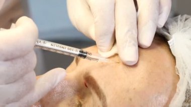 Kadın yüz germe. Şevval özçelik güzellik kadın alın içine güzellik enjeksiyon yapmaya hazır şırınga ile eldiven. Genç güzel kadın sağlık kliniği. 4k