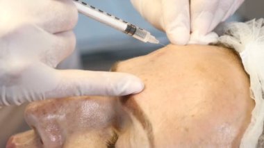 Botox ve Kollajen enjeksiyonları güzellik. Middleaged kadın güzellik enjeksiyon yordamı alır. Eldiven, profesyonel kadın güzellik uzmanı tarafından yapılan enjeksiyonlar kapatın. 4k