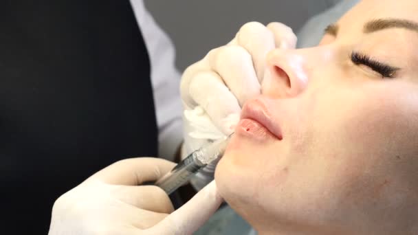 Увеличение губ медицинская процедура. Крупным планом молодая женщина получает инъекции ботокса в клинике здравоохранения. 4k — стоковое видео