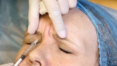 Yüz cilt iğneleri kaldırma. Botox enjeksiyonları yapma güzellik uzmanı. glabellar kaşlarını hat bakım. Kadın yüzü gençleştirme. 4k