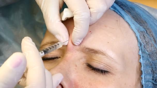 Moderna skönhetsklinik. Ung kvinna blir facial injektioner i bekymmersrynkor frown linje. Ansiktshud lyft injektion. 4k — Stockvideo