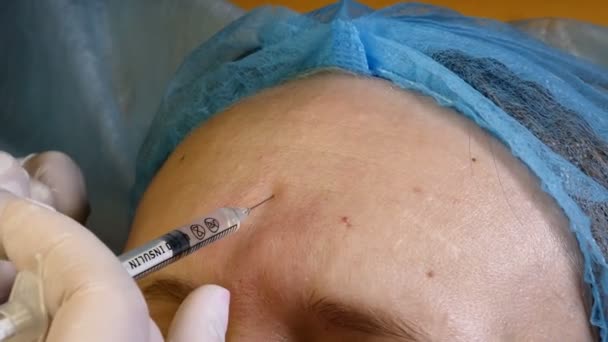 Close up of young woman getting anti-aging injections in a modern beauty clinic. Anti wrinkles procedures made be professional beautician. 4k — Stock Video