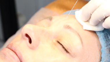 Botox. Kollajen enjeksiyonları. Doktor birden çok enjeksiyonları yapar. Kaldırma yordamı yüz. Güzellik Kliniği kadın kıdemli. 4k