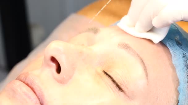 現代的な美しさの概念。手順をアンチエイジング顔を得る医療クリニックのシニア女性のクライアント。美容師は、ヒアルロン注射用マイクロニードルを使用します。4 k — ストック動画