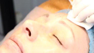 Kadın kıdemli ziyaret güzellik uzmanı. Gençlik enjeksiyonlari. Hyaluronik asit enjeksiyonları glabellar kırışıklık için. 4k