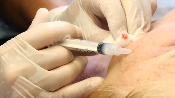 Beauty deskundige. Injectional cosmetologie. Schoonheid injecties in de jaren van verval. Schoonheidsspecialist met een spuit een senior dame injecties worden aangebracht — Stockvideo