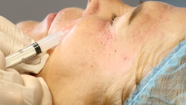 Senior vrouw in cosmetologie kliniek. Close up van vrouwelijke client krijgen gezicht injectie. HD — Stockvideo