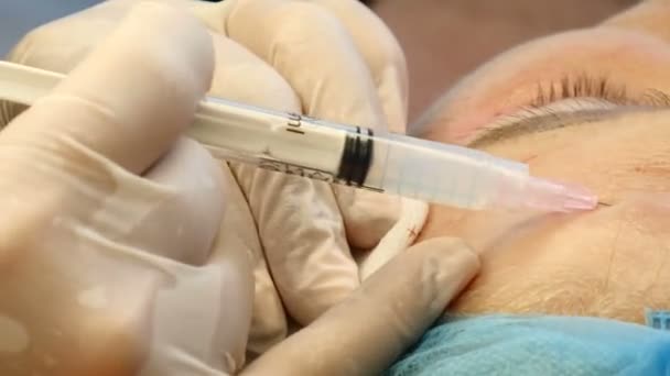 Klientin in rückläufigen Jahren besucht Kosmetikerin in Schönheitsklinik. Frau bekommt Gesicht Schönheit procedure.mesotherapy Kosmetologie Verfahren — Stockvideo