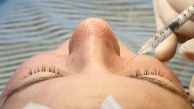 Güzellik enjeksiyonları. Yakın çekim görünümü üzerinde bir güzellik uzmanı yüz yaşlanma enjeksiyon yapma eldiven eller. Kadın güzellik yüz kozmetik prosedür alır. Modern Güzellik Güzellik Kliniği. 4k