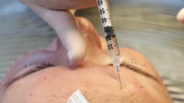 Güzellik Kliniği. İnjectional kozmetik. Botulinum toksin enjeksiyonları güzellik salonda Close-up. alın ve glabellar kaşlarını satır alanı. 4k