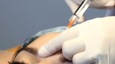 Yüz güzelliği yordamı bir kanül ile portre vurdu. Modern Güzellik Kliniği. Orta yaşlı bir kadın yüz enjeksiyon sağlık kliniğinde alıyorum. Şevval özçelik güzellik enjeksiyon yapma eller. HD