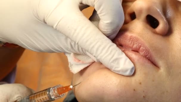 Moderní kosmetický průmysl. Žena středního věku v klinice krásy dostat obličejové procedury. Face lifting s injekční stříkačkou. Zblízka. HD — Stock video