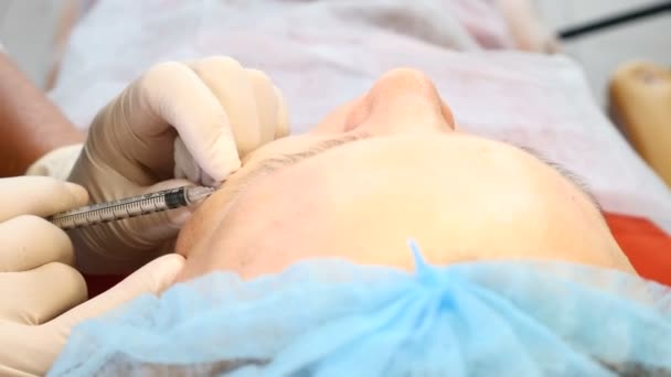 Το Top view την γυναίκα να πάρει προσώπου ομορφιά διαδικασία σε μια κλινική της υγειονομικής περίθαλψης. Βολή closeup της αισθητικός χέρι με μια σύριγγα. Αντιμετωπίζουν ανύψωσης διαδικασία. 4k — Αρχείο Βίντεο