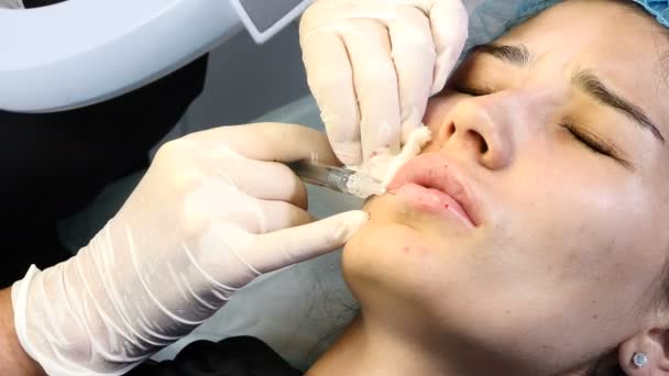Kosmetické ošetření. Moderní kosmetické kliniky. Mladá žena dostane lip augmentace postup. Filler injekce na zdravotnické klinice. Zblízka. 4k — Stock video