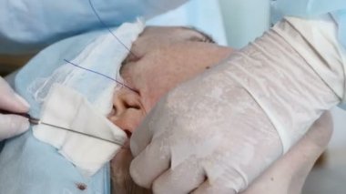 Yüz iş parçacığı yordam kaldırma. Onun 50 sonlarıyla'Güzellik Kliniği kadın kıdemli. Closeup çekim Şevval özçelik güzellik el yüz cilt toparlama yapmak. Kozmetik kavramı. 4k
