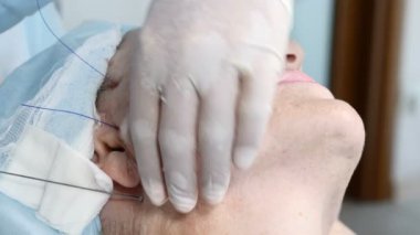 Kozmetik prosedür yaşlanma belirtileri ortadan kaldırmak için. Yüz, yüz kontur, plastik cerrahi kavramı yaş 40-50 yıl için güzellik. Güzellik Kliniği yaşlı hastada. 4k