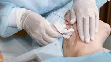 Yaşlanma belirtileri gizlemek için acı güzellik yordam. Üst düzey bayan hasta yüz cilt ile tıbbi konuları toparlama alıyorum. 4k