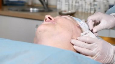 Panoramik closeup çekim cerrahi yüz yordam kaldırma. Güzellik cerrahi işlem yaşlanma belirtilerini gizlemek için. Sarkık yüz cildi canlandıran. Yüz dağılımı. 4k