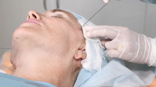 Mujer mayor en la clínica de belleza. Sergeon en guantes haciendo procedimiento de elevación de hilo para la piel de la cara para ocultar la edad. Contorno facial. 4k — Vídeo de stock