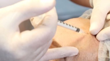 Yüzüne botox enjeksiyonu. Güzellik yordam kaldırma yüz. Güzel genç kadın sağlık kliniği cilt gençleştirme alıyorum. 4 k'dan fazla vurdu