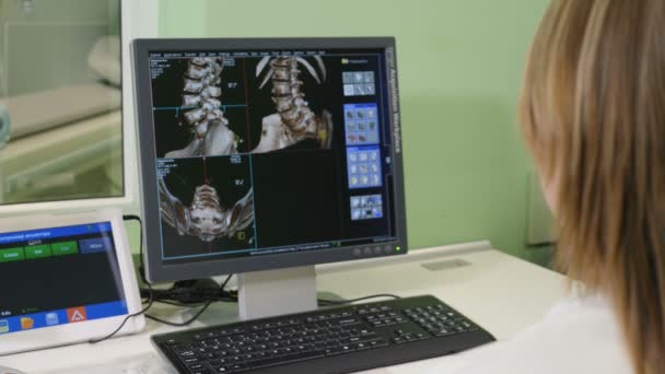 Conceito de saúde. Médico do Hospital a fazer TAC. Over the Shoulder Shot of female Medical Scientist Trabalhando com Imagens de Digitalização em um Computador Pessoal em Laboratório. Pesquisa neurológica — Vídeo de Stock