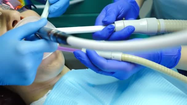 In modern dentist office. Closeup shot of dental procedure. Female patient getting teeth treatment. Dentist Using Tools, Vacuum, Drill, Equipment, Instruments in clinic. 4k — Stock Video