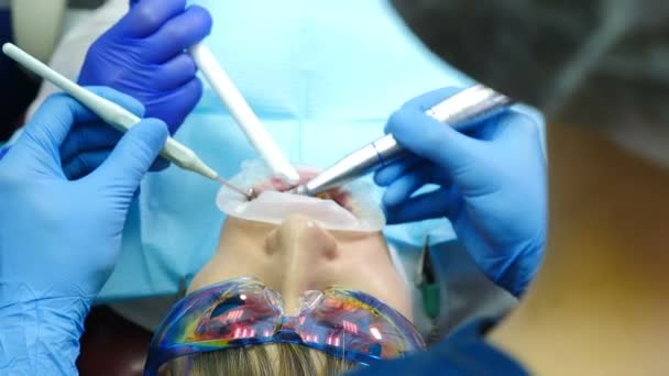 牙科诊所的概念。牙医用口腔扩张剂治疗女性患者的特写镜头。在现代牙科诊所。顶部视图。正畸医生与助理一起工作。4k — 图库视频影像