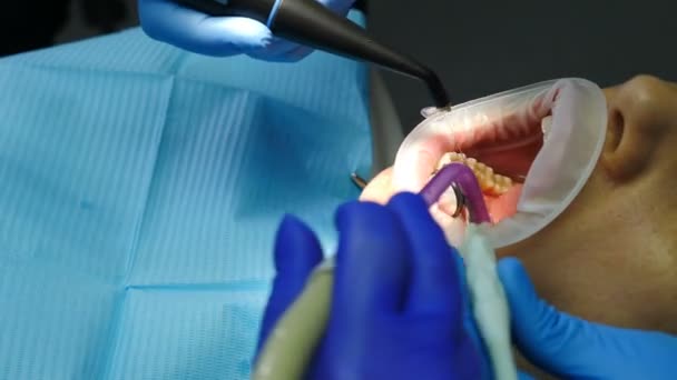 La doctora trata a la paciente en su gabinete. Primer plano de la mujer joven con un expansor en la boca en el consultorio dental. Dentista que usa herramientas, vacío, taladro, equipo, instrumentos en la clínica. 4k — Vídeos de Stock