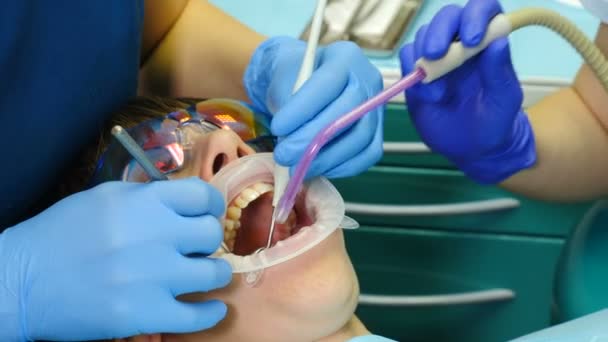 В современном кабинете дантиста. Крупный план стоматологической процедуры. Пациентка получает лечение зубов. Стоматолог с помощью инструментов, вакуума, дрилла, оборудования, оборудования в клинике. 4k — стоковое видео