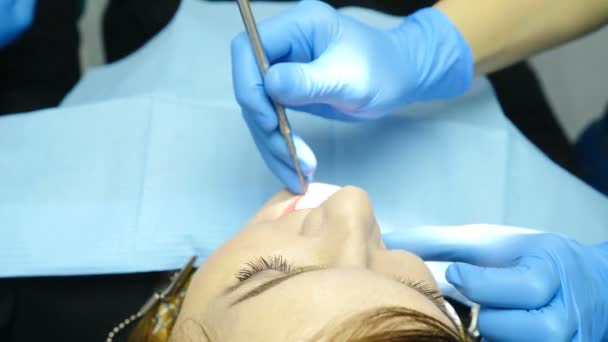 Im Kabinett der Berufspraxis. Zahnarzt untersucht Patienten aus nächster Nähe. Arzt hält zahnärztliches Werkzeug - Spiegel. Ansicht von oben. 4k — Stockvideo