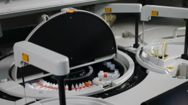 Hastalık önleme konsepti. Analiz öncesi otomatik Biyokimya analizörü kimyasal madde sıvı koyarak mavi eldiven kadın uzman el. Biyolojik numunelerin araştırma süreci