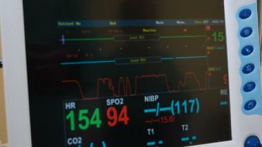Bebek sağlığı kavramı. Çoklu parametreli hasta monitör ekranı. Tıbbi ekran arayüzü. Çeşitli ölçülen St segmenti ve kalp krizi algılama, hız yapıcı analizi ve aritmi ile ekran