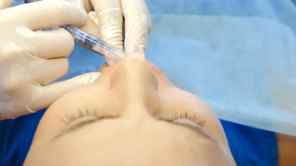 Une femme médecin-cosmétologue fait des injections aux lèvres. concept de beauté et de cosmétologie. Vue de dessus. 4k — Video