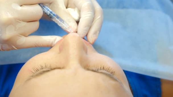 Augmentation des lèvres, gros plan. Femme médecin cosmétologue utilisant la seringue pour la procédure d'augmentation des lèvres. Concept de salon de beauté. Concept d'injection cosmétique beauté. 4k — Video