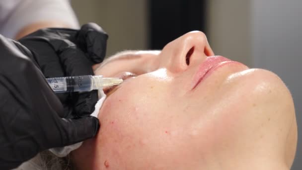 Mesoterapia, elevação da pele e rejuvenescimento. Conceito de clínica de beleza. Cosmetologist que faz a injeção do mesotherapy. Mesoterapia com microagulhas. De perto. Tratamento da zona facial feminina na clínica. 4 k vídeo — Vídeo de Stock