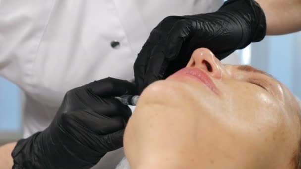 Conceito de clínica de beleza. Cosmetologist que faz a injeção do mesotherapy. Mesoterapia com microagulhas. De perto. Tratamento da zona facial feminina na clínica. Mesoterapia, elevação da pele e rejuvenescimento. 4 k vídeo — Vídeo de Stock