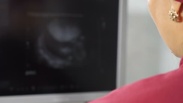 Вид сзади на экран монитора с черно-белым изображением на нем. Женщина-врач осматривает пациента. человек получает внутренние органы исследуется с помощью ультразвукового медицинского устройства. 4 k видео — стоковое видео