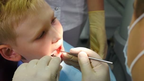 Concepto de salud dental. Primer plano del dentista masculino tratando a un niño pequeño en la clínica dental. Odontología pediátrica. El dentista examina los dientes del niño sosteniendo herramientas médicas. 4 k imágenes — Vídeo de stock