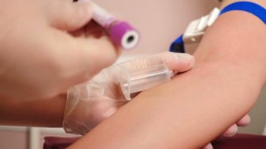 Sağlık sigortası konsepti. Klinikteki laboratuvar. Kadın laboratuvar asistanı test için venöz kan alıyor. HIV Hepatit Testi. 4k görüntü