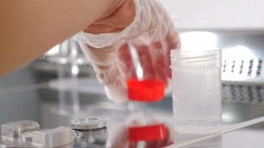 İnsan analizi konsepti. Laboratuvar uzmanı, test bankasını biyomateryalle kapatıyor. Laboratuvarda sperm kabı. 4k video