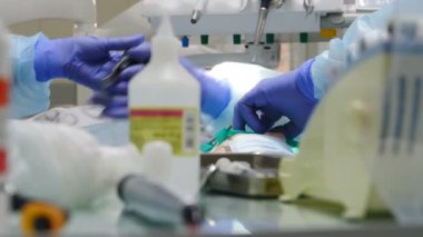 Modern klinikte yapılan diş ameliyatının yakından çekimi. Doktorların takım çalışması. Hasta cerrahi operasyon ve ağız dekoltesi tedavisi görüyor. 4k video
