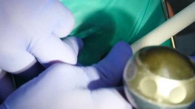 Ağız cerrahı delme tedavisi. Modern diş kliniğinde asistanı olan bir diş hekimi. Modern klinikte diş cerrahisi. Hasta cerrahi bir operasyon geçiriyor. 4k video