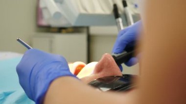 Diş tedavisi prosedürü. Diş muayenehanesinde gözlüklü erkek hasta, yakın plan. Çalışırken dişçi aleti. Stomatoloji kliniğinde dişçi seansı. Hastalıklı dişlerin tedavisi. 4 bin.